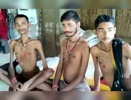 Family Rare Disease: रीवा में रहस्यमयी बीमारी से जूझ रहा परिवार