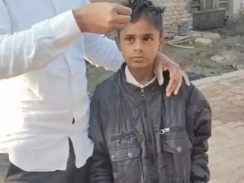 60 people from 3 villages suddenly went bald in Maharashtra