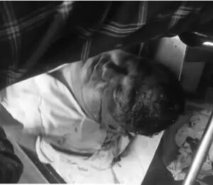 ASI की मौत