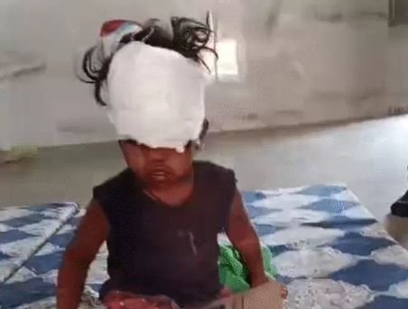 इंदौर आवारा कुत्तों का हमला