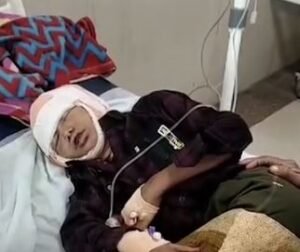 घायल बच्चा