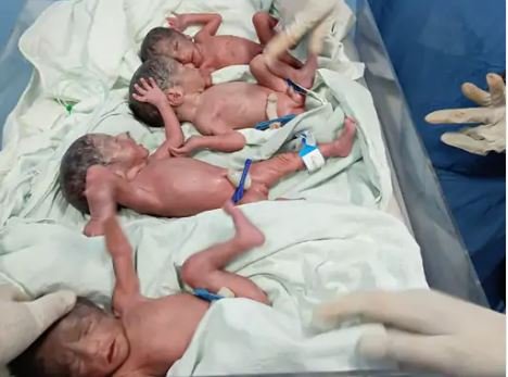 एक साथ चार बच्चे