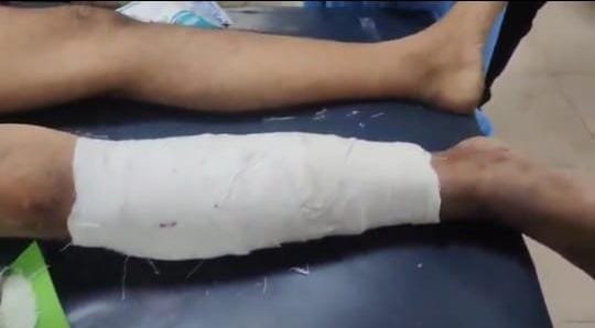 Short Encounter in Bhopal