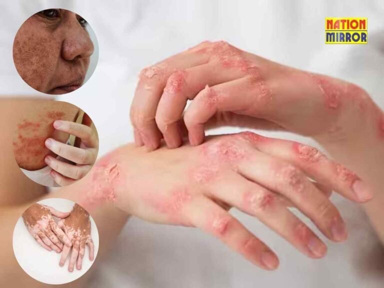 Skin Diseases Causes