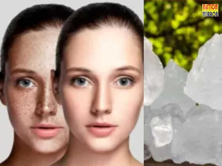 Wrinkle Removal Home Remedy