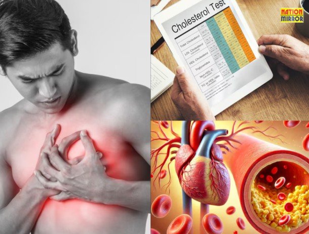 Cholesterol Causes and Remedies