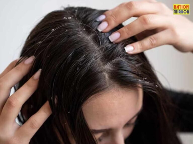 Dandruff and Itchy Scalp Treatment