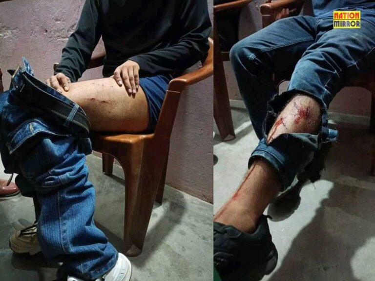 Leopard Attack Yamunotri National Highway