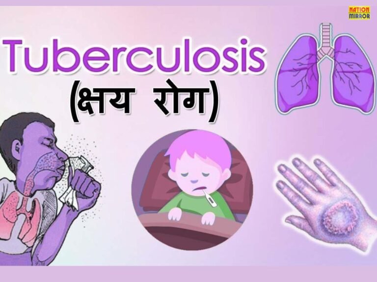 Tuberculosis Symptoms and Treatment