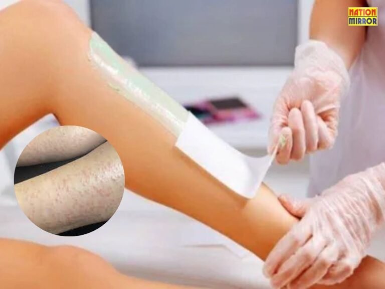 Post-Waxing Skin Care