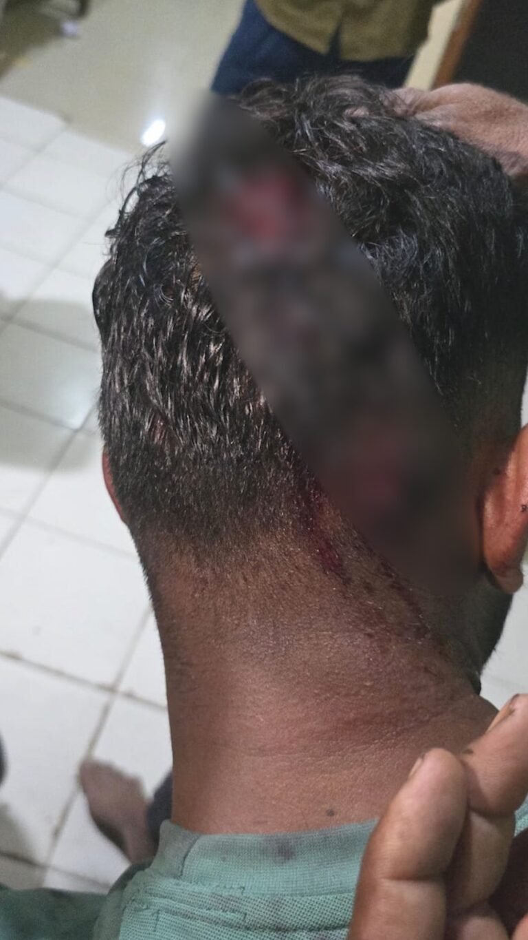 Bhopal youth attack: