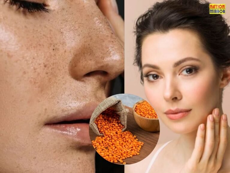 Face Dark Spots Treatment