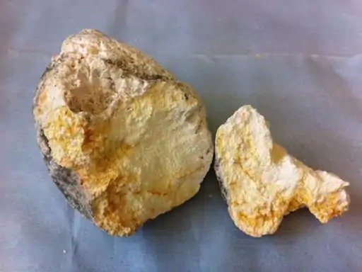 gujarat-ambergris-whale-vomit-arrest-surat-bhavnagar-5-72-crore