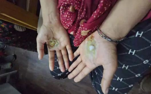 अंधविश्वास में महिला से ज्यादिती