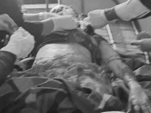 गंभीर रूप से घायल दंपत्ति