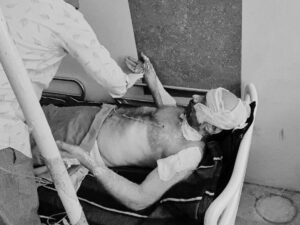 देवास में दंपत्ति ने लगाई खुद को आग