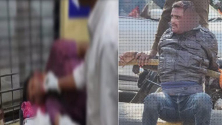 attack on sukma sdop: सुकमा में ‘रंगीन मिजाज’ SDOP पर जानलेवा हमला, आरोपी दुर्ग से लाया गया