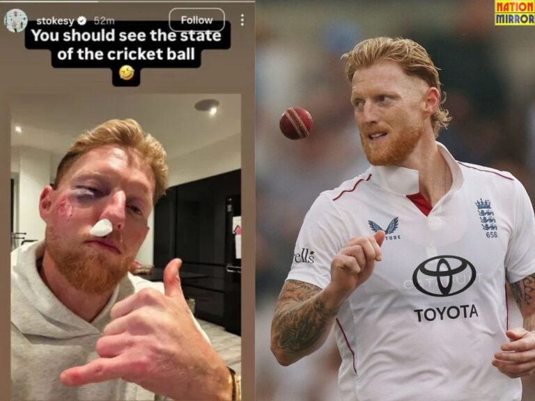 Ben Stokes Face Injury