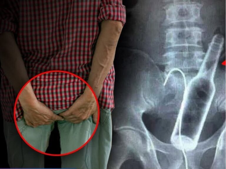 Agra Man Bottle Anus