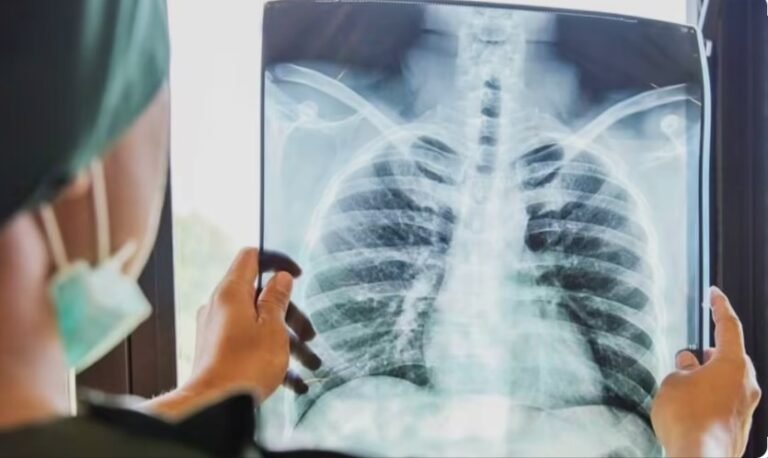 टीवी की जांच