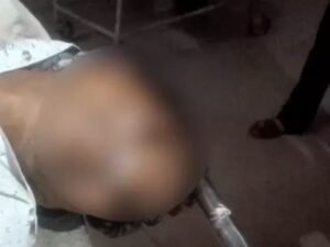 चूहों ने छगनलाल का चेहरा बुरी तरह से कुतर दिया था।